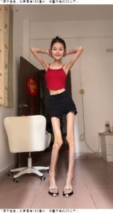 身長160センチ、体重25キロの女性「踊る骸骨」と揶揄されるも「もっと痩せたい」（中国）