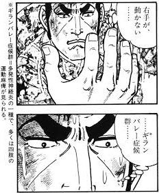手や足にしびれや痛みのある人