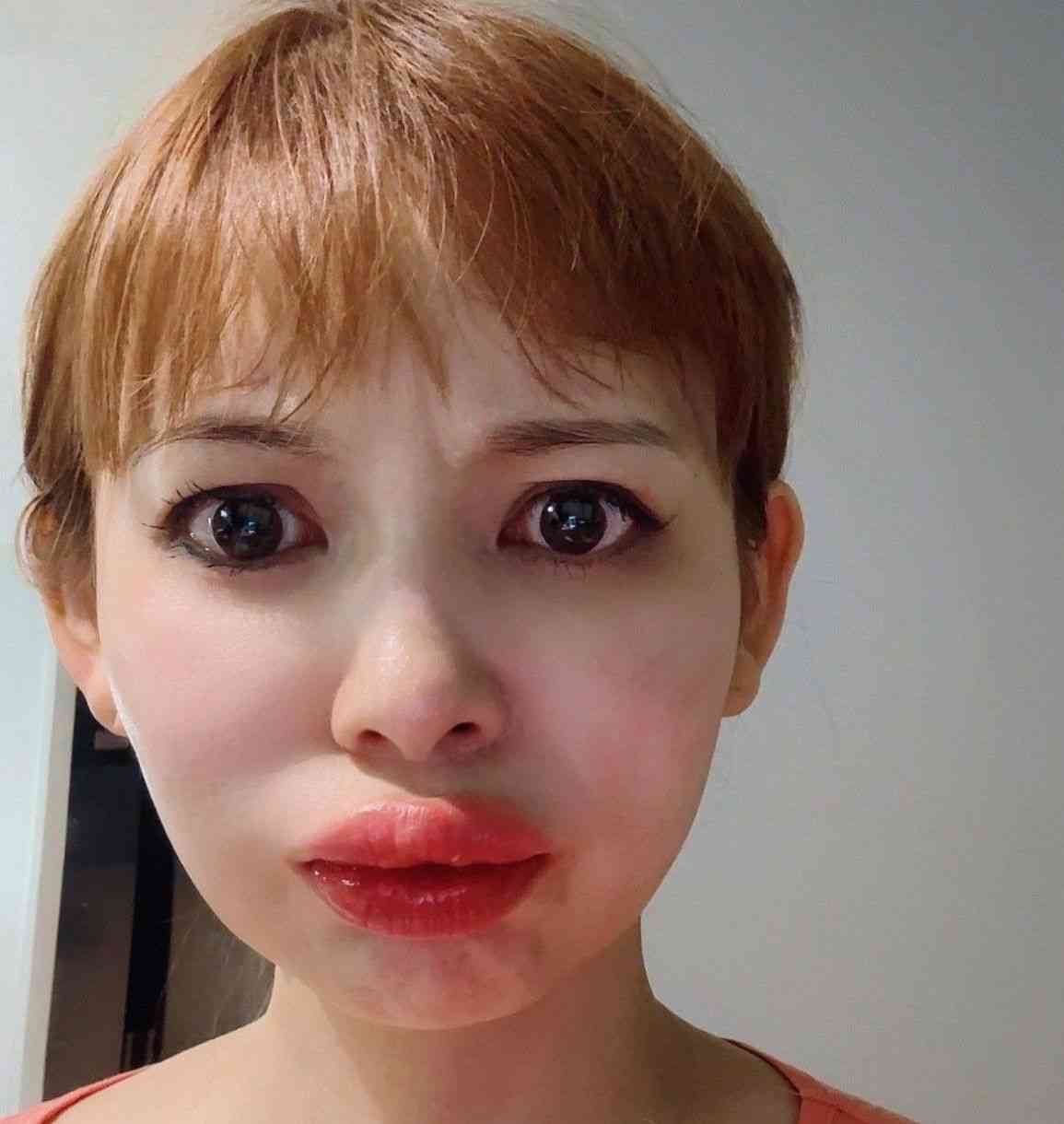 中川翔子「くちびる5倍になった」ひどいアレルギー症状を訴え、近影に心配の声「命に関わる前に…」：「おっ！」でつながる地元密着のスポーツ応援メディア 西スポWEB OTTO!