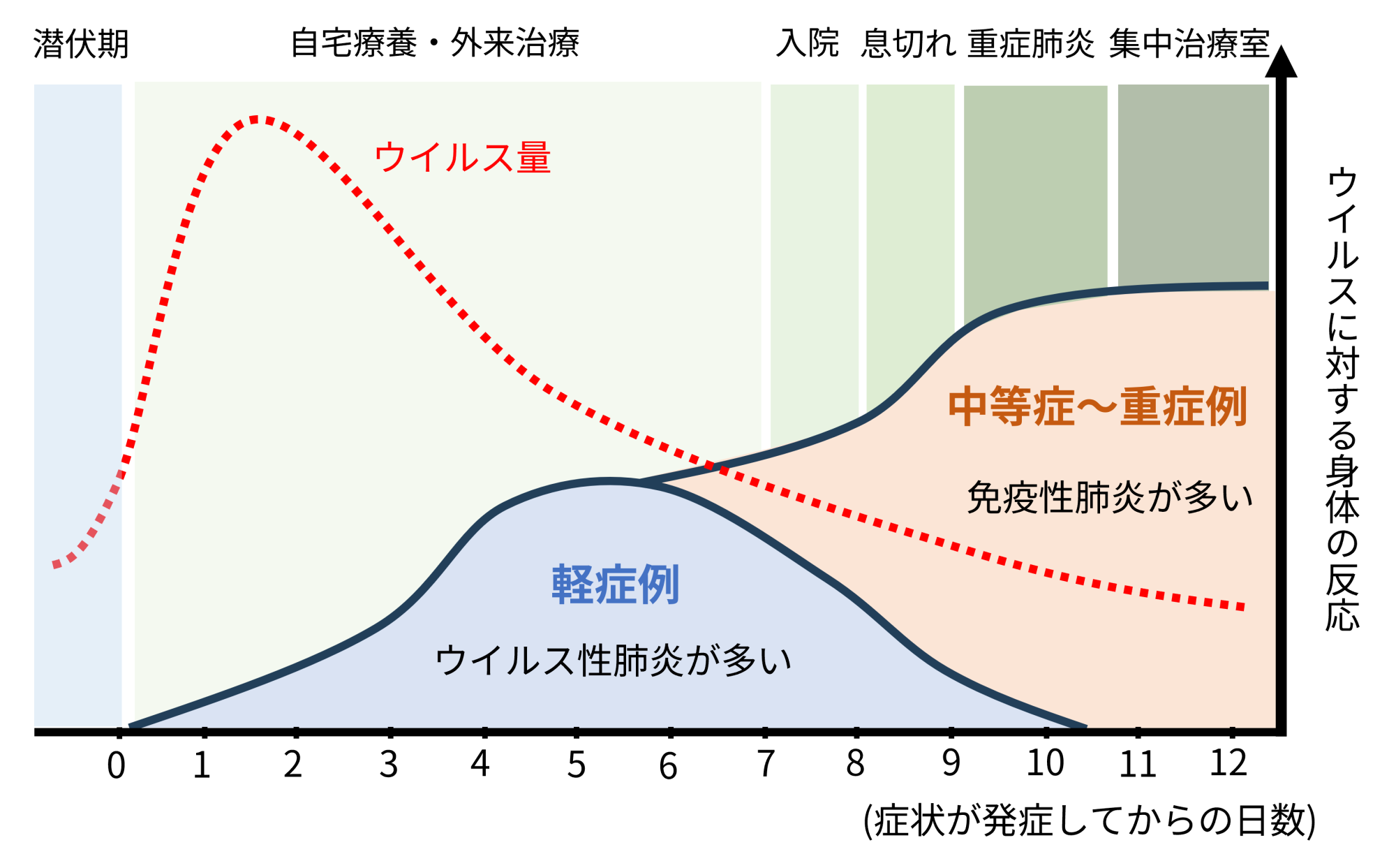 新型コロナ　時間差でやってくる「免疫性肺炎」に注意