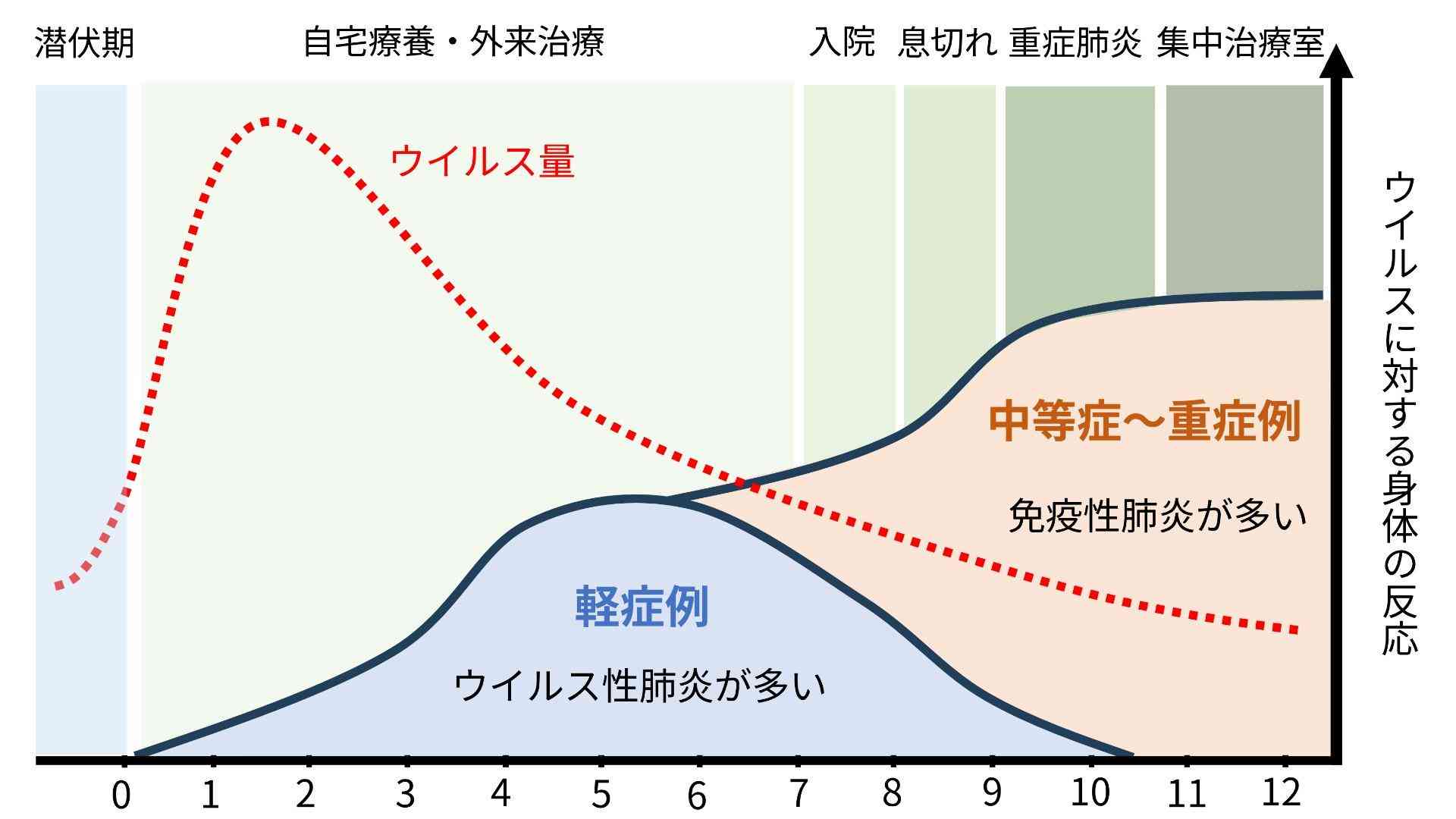 新型コロナ　時間差でやってくる「免疫性肺炎」に注意（倉原優） - エキスパート - Yahoo!ニュース