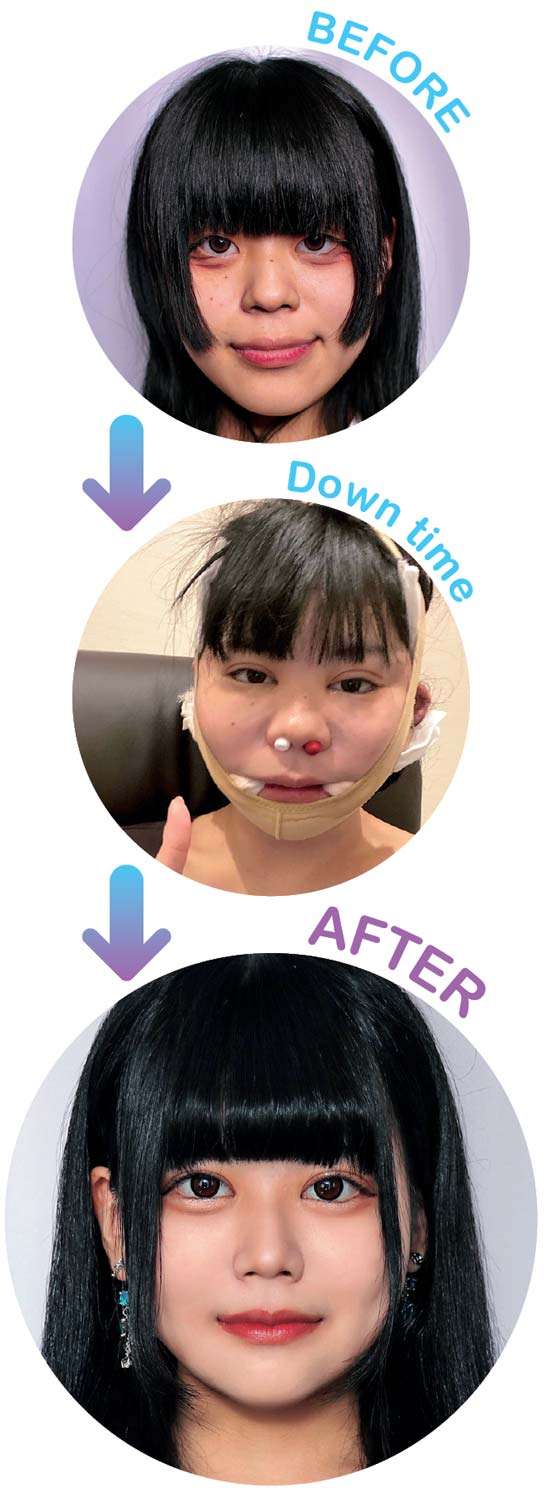 “整形総額5000万円超”のアイドルグループ「費用は全額タダ」16歳のメンバーも親の承諾を得て整形