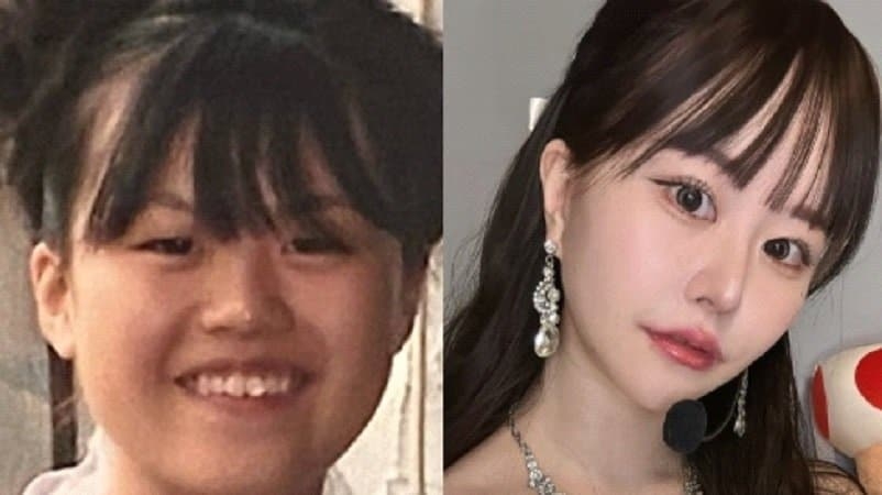 「うんざりする！」“美容診断”でのマウンティングに疲弊する女性が続出…総額1350万超の整形アイドルが勧めるマインド「『好き』っていう感情に従って」 | 集英社オンライン | ニュースを本気で噛み砕け