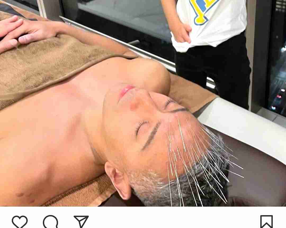 エグい…！窪田正孝に続いて團十郎らのハリだらけ写真も。“魂を浄化する”施術の謎ワールド | 女子SPA！