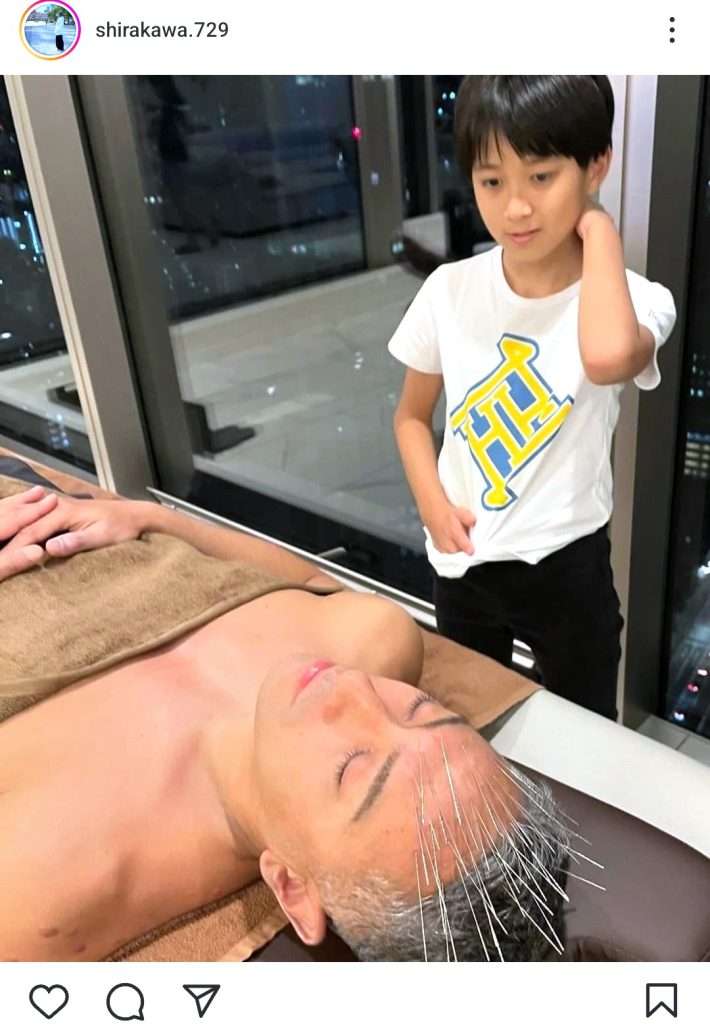 エグい…!窪田正孝に続いて團十郎らのハリだらけ写真も。“魂を浄化する”施術の謎ワールド