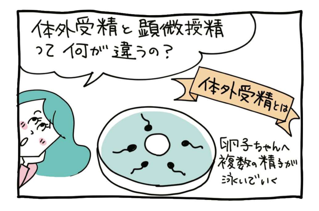 体外受精と顕微授精の違いって？どっちを選ぶか迷ったらどうする？【医師監修／体外受精はコワくない】 | 不妊治療・妊活のクリニック探し・情報収集ならあかほし（赤ちゃんが欲しい）