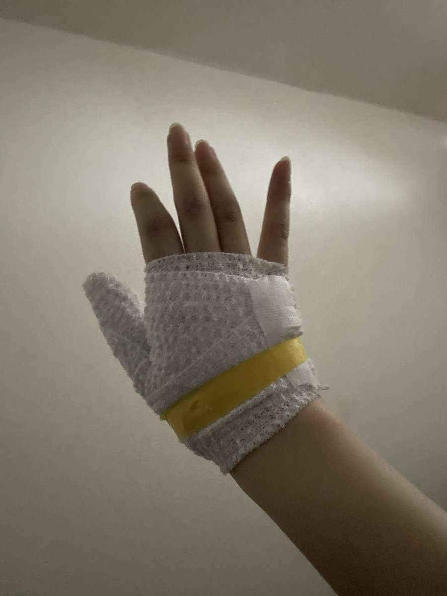 線香花火と思い込み...火傷で絶叫 自宅ハプニングで反省、2.5次元VTuber「今後はやらない」