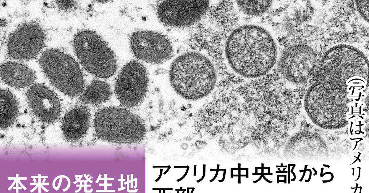 「緊急事態宣言」２度目のエムポックス（サル痘）　日本でも散発的に発生、２４８例を確認 - 産経ニュース