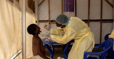 エムポックスで緊急宣言　アフリカ連合、大陸外拡大恐れも