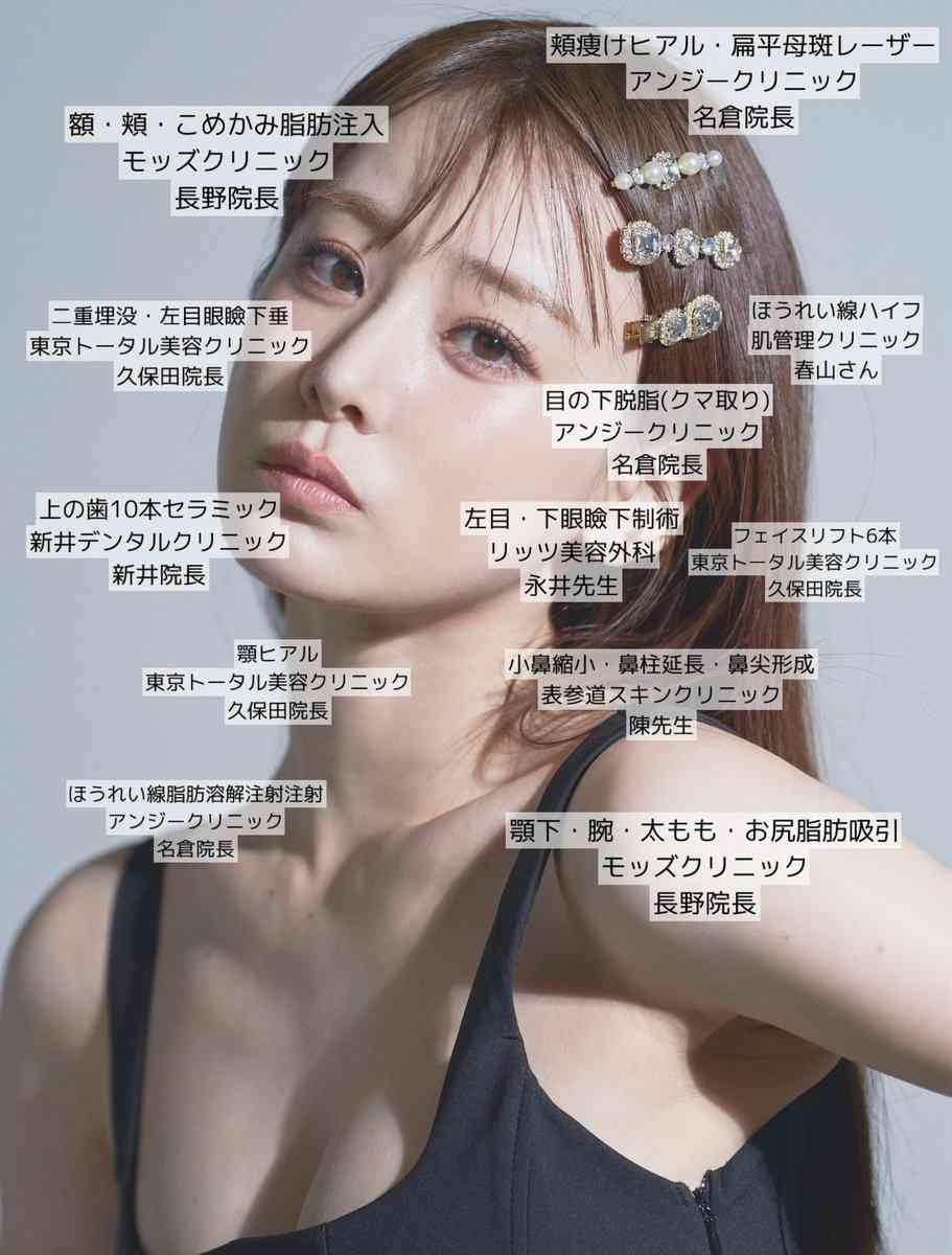 “顔の全パーツ整形済み”の福岡みなみ「すればするほど変な顔になる」　美容整形について率直な心境を告白