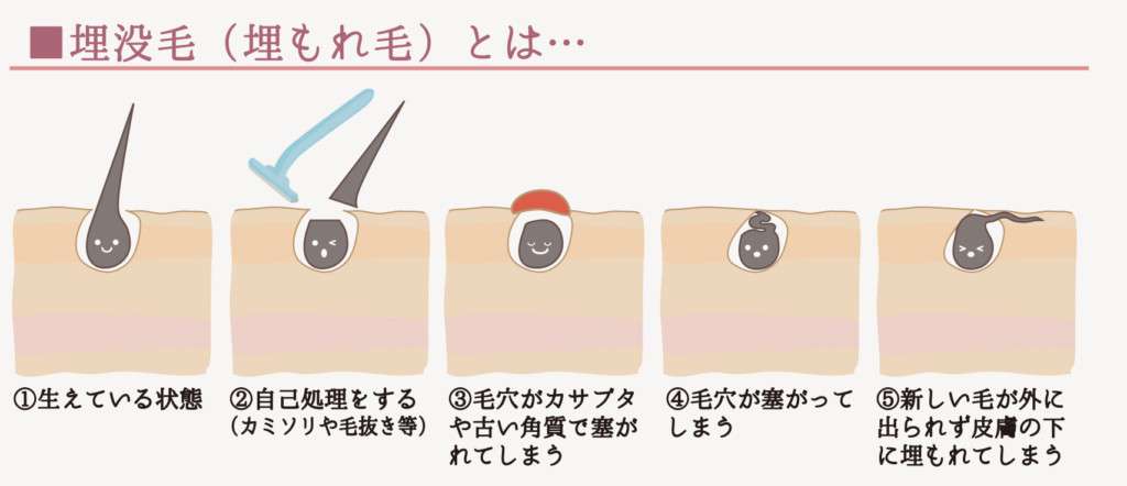 「小学生がムダ毛なんか気にするな」　親から一蹴された女の子を救った出来事　公認心理師が子どもとの接し方で気をつけたいと考えていることとは