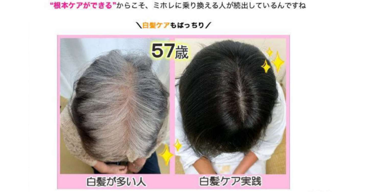 アフィリエイト広告が不当表示、育毛剤EC会社に東京都が景表法違反で措置命令 | ネットショップ担当者フォーラム