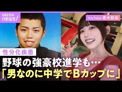 【性分化疾患】「トランスジェンダーとは違う」当事者・青木歌音の苦悩…体も