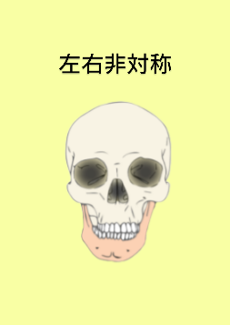 顎変形症の手術した方どうでしたか？
