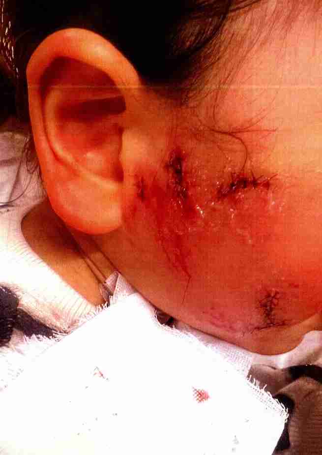 商業施設で大型犬に噛まれ大怪我　だんまりを決め込む東急グループ