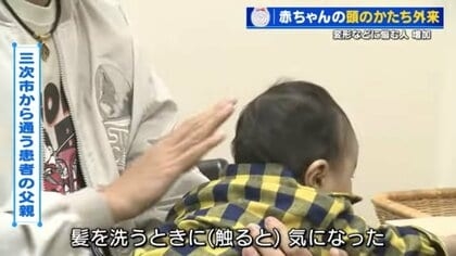 「赤ちゃんの頭の形が気になる」 ヘルメットで矯正の外来に受診者急増　生後6か月までに始めると効果的　広島大学病院