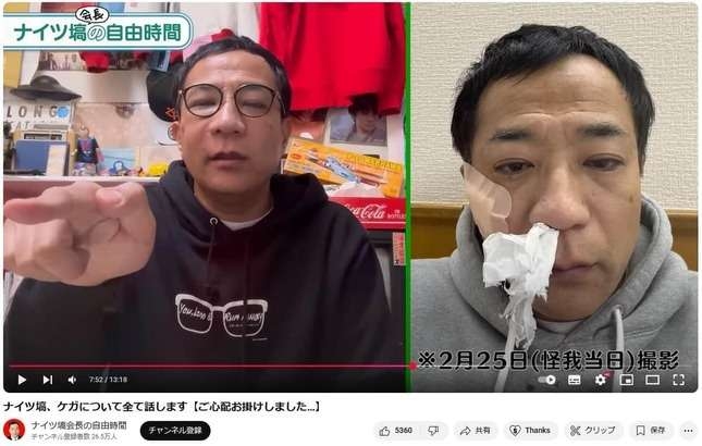 ナイツ塙「顔面骨折」顛末明かす　「真っ暗で、側溝に落っこって...」痛々しい写真も公開