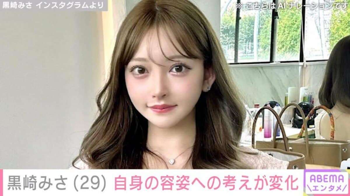 整形総額1300万円超、32歳YouTuberが今昔比較　アンチコメに負けず「私の好きな私になれました！」