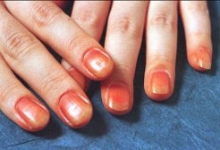 鳳仙花爪染め | 東九条マダン公式ページ