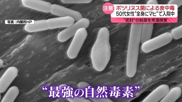 ボツリヌス菌による食中毒…50代女性が全身マヒの症状で入院中　“密封”の総菜を約2か月常温保管（日テレNEWS NNN） - Yahoo!ニュース