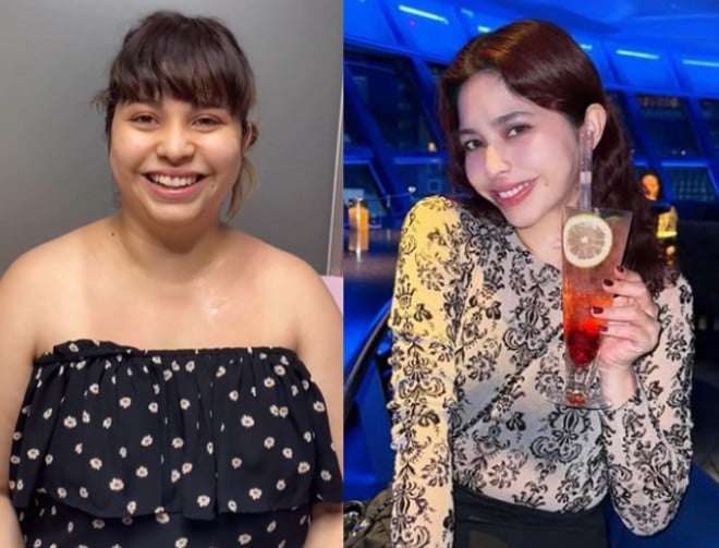 「痩せたら結婚するよ」好きな人の一言で決意、“胃切除”の医療ダイエットで40kg減量の女性「今の自分を全力で愛して、楽しんで欲しい」