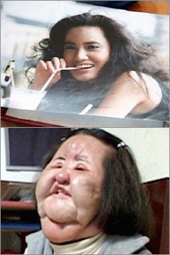 口裂け女に会ったらどう答えたらいい？