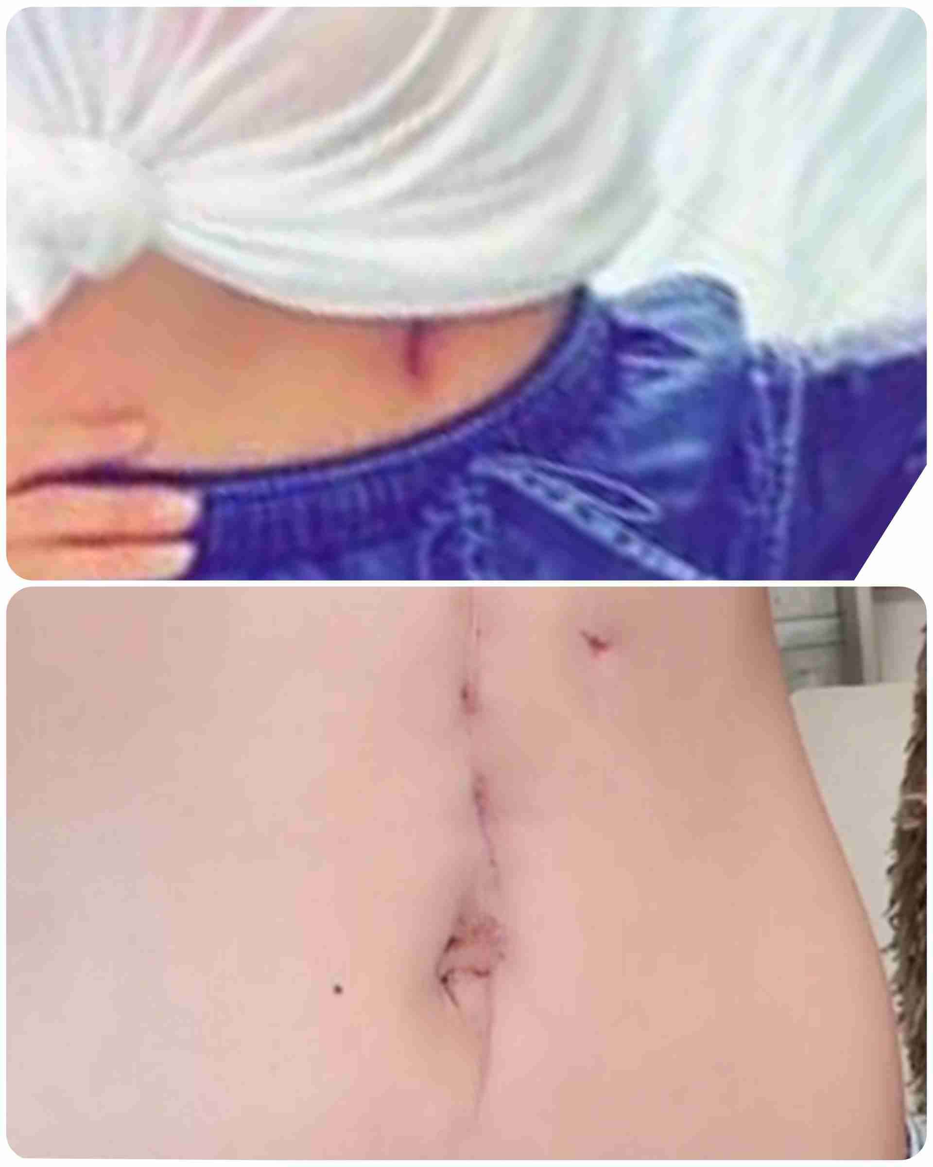 おすすめのゲーミングチェア