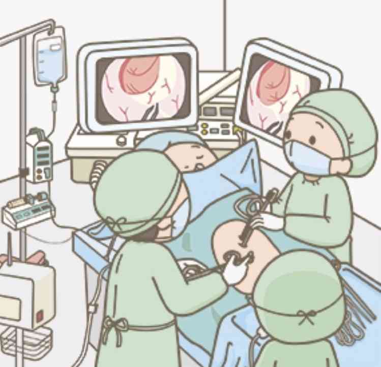 腹腔鏡手術経験者の方