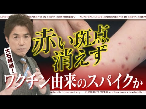 赤い発疹消えず…ワクチン由来のスパイクタンパクか 訴訟を起こした女性の今【大石が深掘り解説】