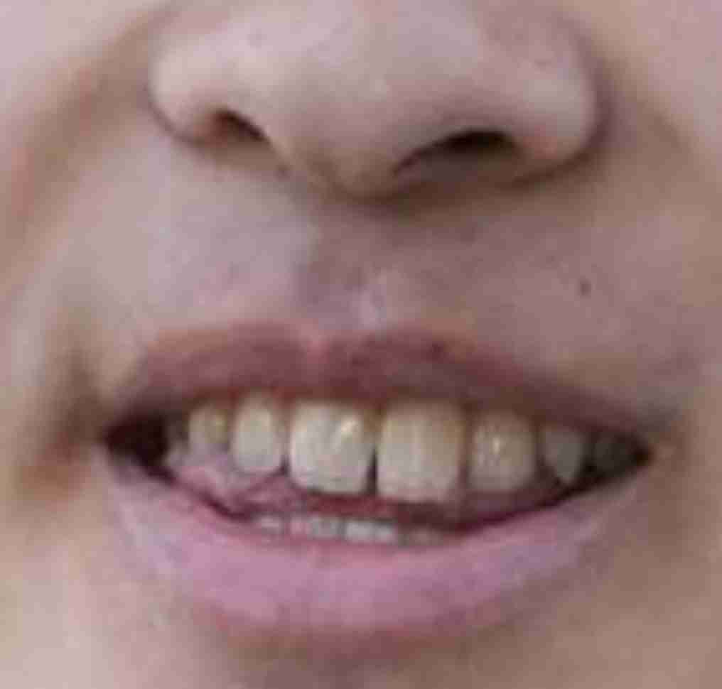 比較されがちなこと