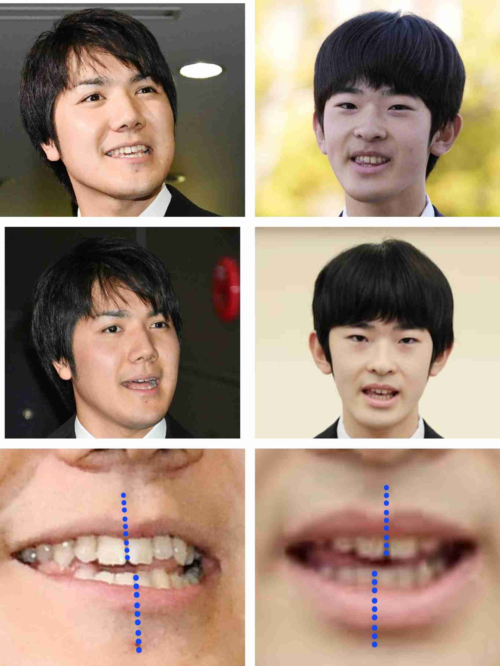 比較されがちなこと