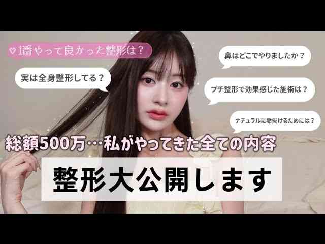 元NGT48メンバーが整形箇所と総額を赤裸々告白「高かったんですけど、早めに可愛くなってうれしい」