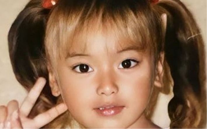 「もうやめて！ 痛い痛い痛い！」“大好きなママ”に呪いをかけられて「整形した」女子中学生モデルの不幸 | それぞれの美容整形、それぞれの理由 | 文春オンライン