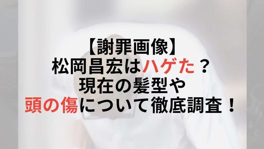 【謝罪画像】松岡昌宏はハゲた？現在の髪型や頭の傷を徹底調査！