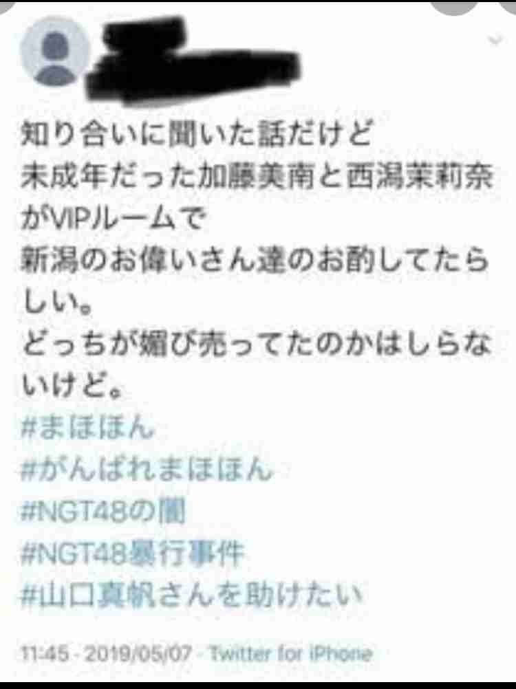 元NGT48メンバーが整形箇所と総額を赤裸々告白「高かったんですけど、早めに可愛くなってうれしい」