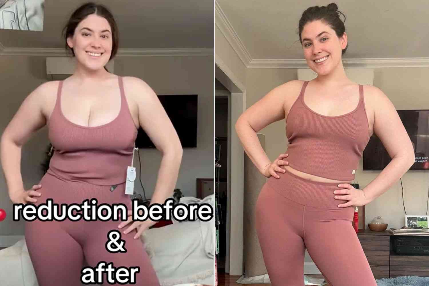 「バストEカップ→Bカップへ」胸を小さくする手術を受けた28歳女性、その理由と偏見について告白。過去には水着モデルを務めたことも