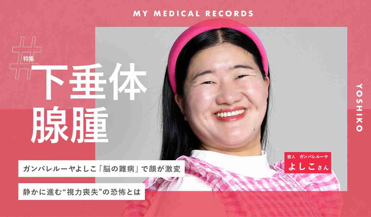 ガンバレルーヤよしこ「脳の難病」で顔が激変。静かに進む “視力喪失” の恐怖とは