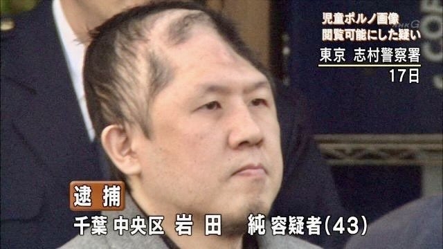 赤ちゃんのヘルメット治療が物議…“親心”が子のルッキズムを助長?高須幹弥院長「責任を感じて『治してあげたい』気持ちはわからなくもない」