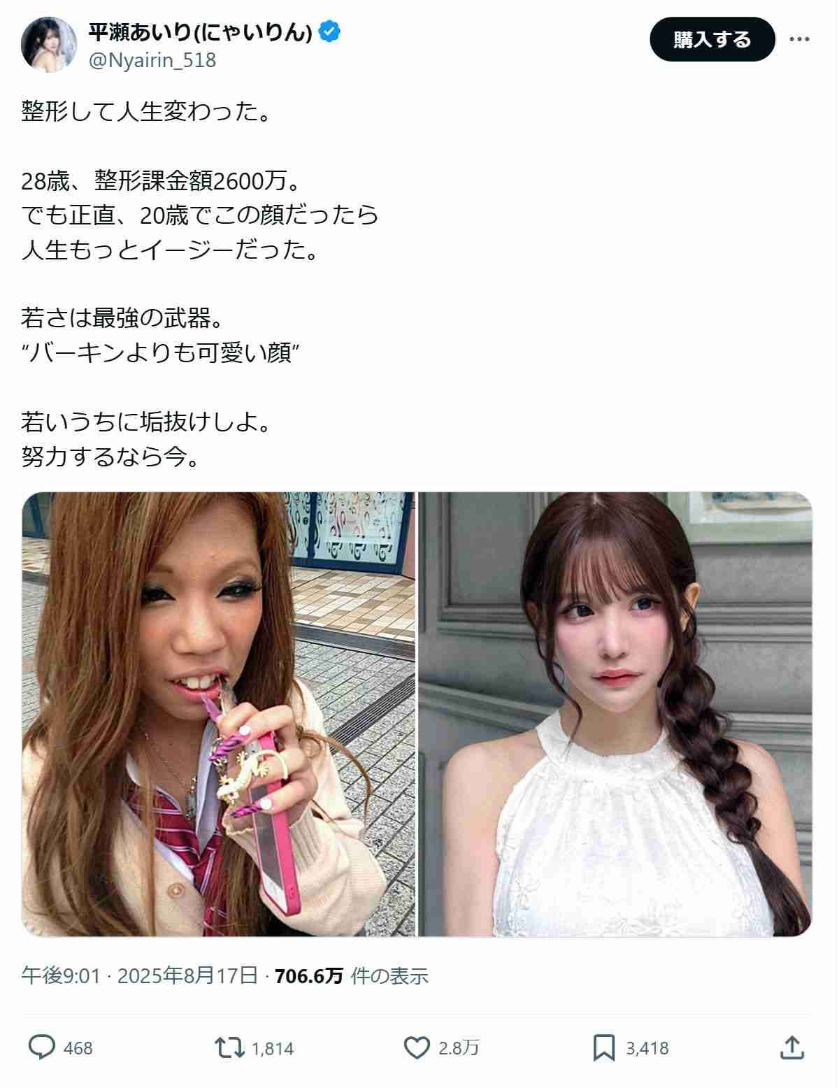 高須克弥院長が謝罪、整形総額2600万円のモデルの“前後”写真に「嘘つき!」投稿の経緯説明