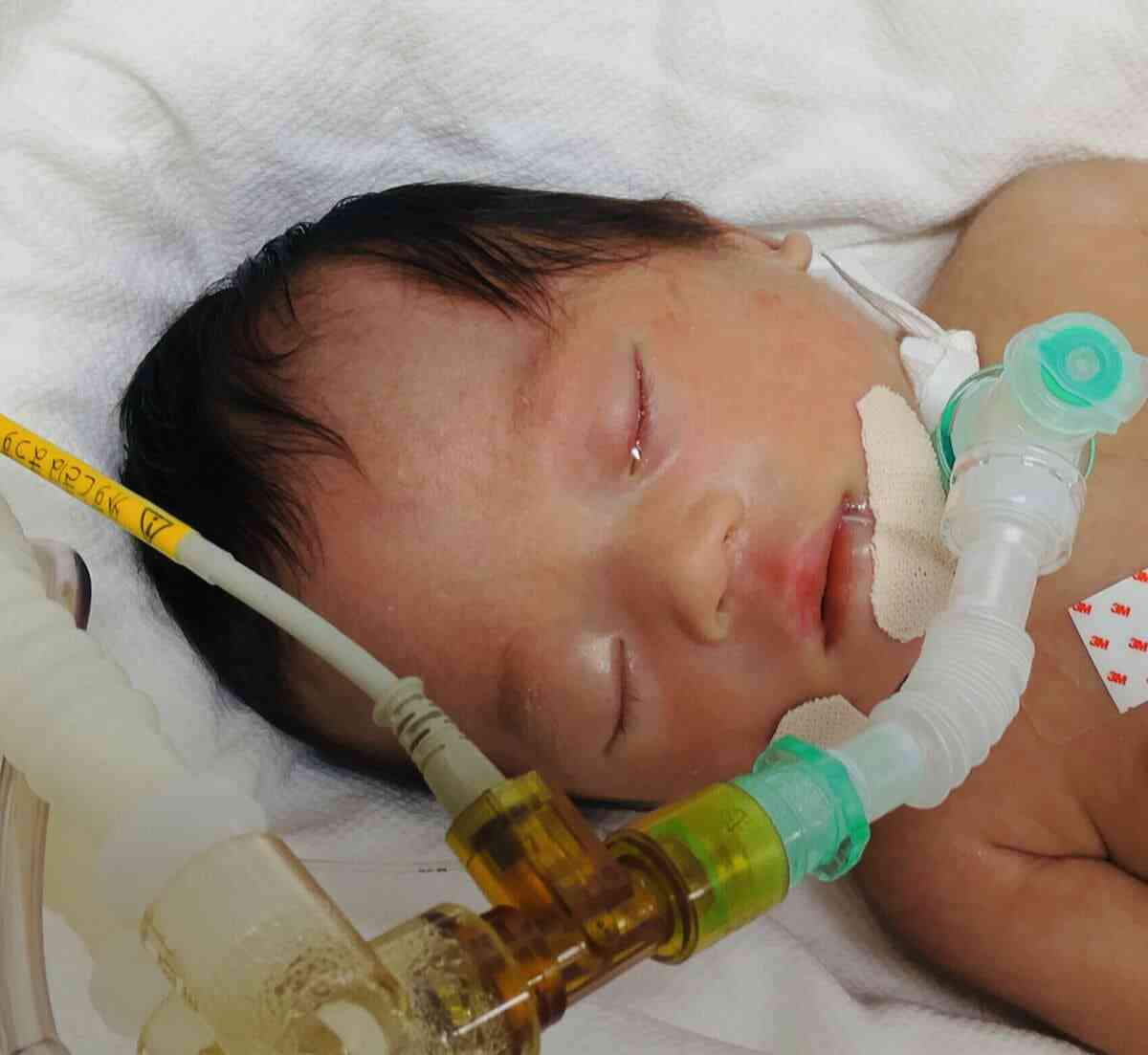 車にはねられた妊娠中の娘、死の間際に帝王切開で産んだ孫には重い障害、なのに「加害者は胎児への責任なし」だと？(1/5) | JBpress (ジェイビープレス)