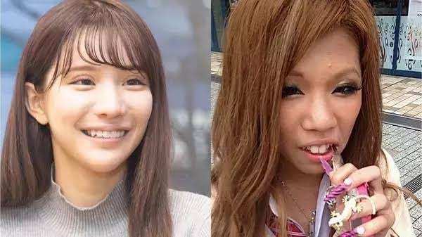 高須克弥院長が謝罪、整形総額2600万円のモデルの“前後”写真に「嘘つき!」投稿の経緯説明