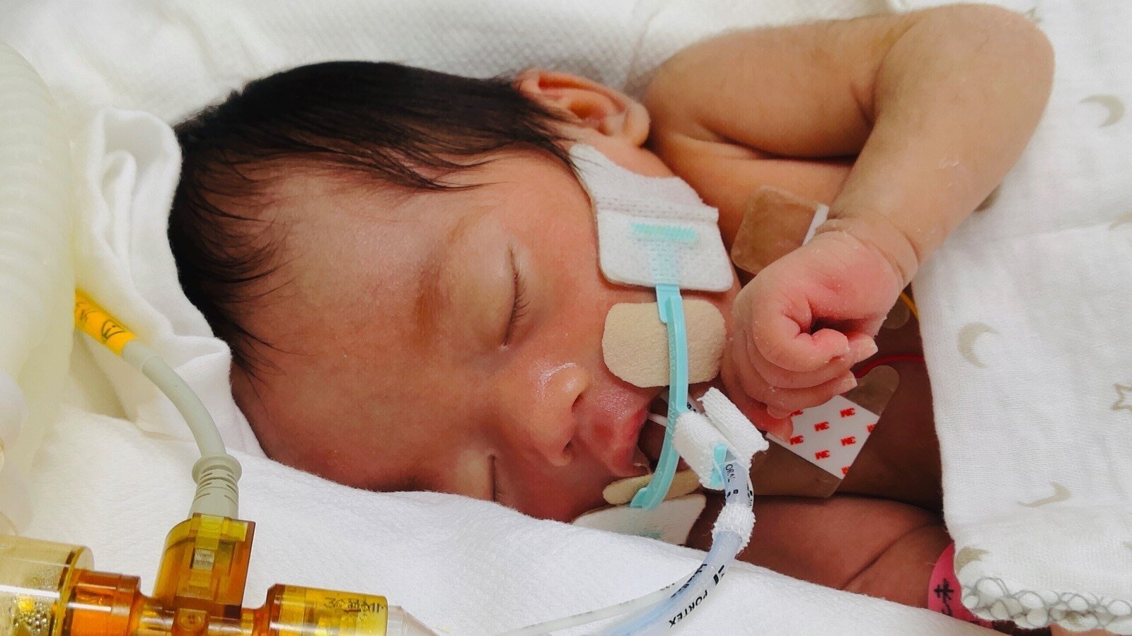 オンライン署名 · 妊婦の死亡事故　緊急帝王切開で産まれ、重度の障害を負いながら懸命に生きる娘は被害者ではないのか？「胎児への加害行為に対して過失運転致傷での起訴を求めます」（起訴後は厳罰を求めます） - 日本 · Change.org