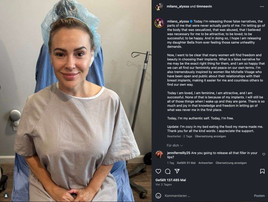 豊胸インプラントの除去手術、米俳優が写真で投稿「性的対象になった体を手放します」