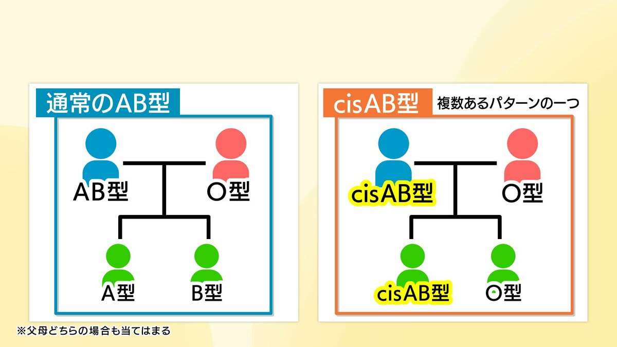 AB型とO型の両親からありえない血液型の子が？　全国に約1500人　四国に多い「cisAB型」とは | 愛媛のニュース - Nスタえひめ｜あいテレビは6チャンネル