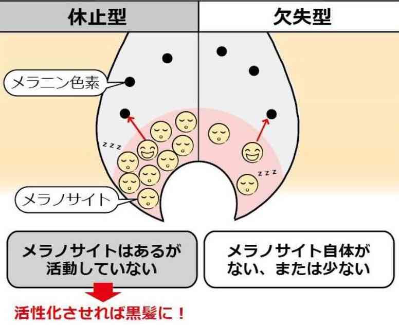 あなたの白髪はどんなの?
