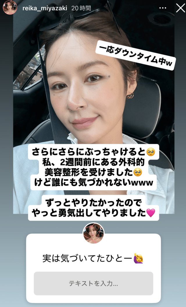 「鼻変わりましたね」の声も…元EXILE黒木啓司の妻・宮崎麗果、整形告白&ダウンタイム公開 過去に整形説を否定