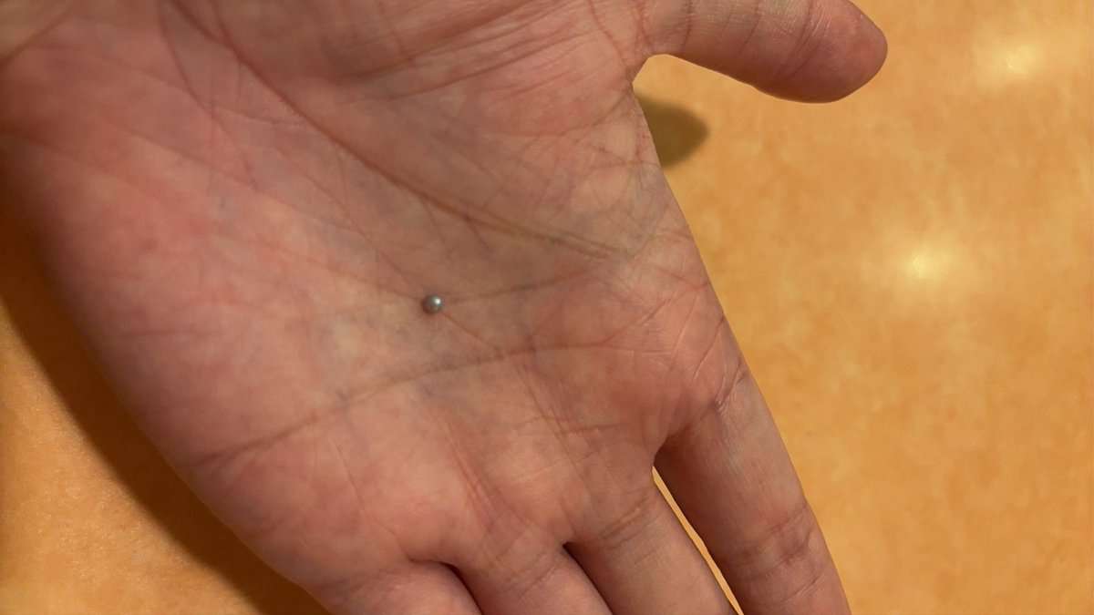 サイゼリアの「ムール貝」から“高級お宝“を発見!→「ラッキーすぎる!」「一攫千金ですね」と驚愕の声