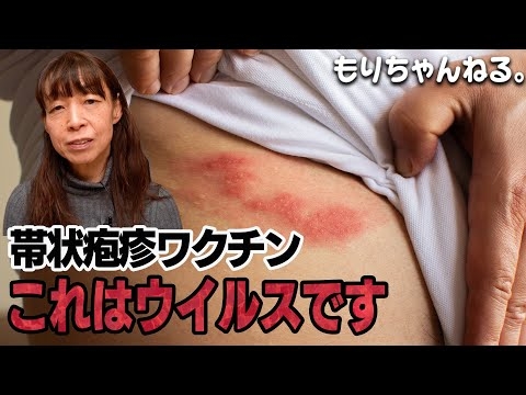 帯状疱疹ワクチン ※本編訂正あります説明欄記載