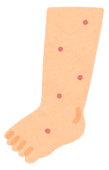 ウィルス性いぼ