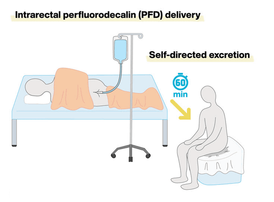 2024年のイグノーベル生理学賞を受賞した日本人の「尻呼吸」に関する研究が実用化に近づく